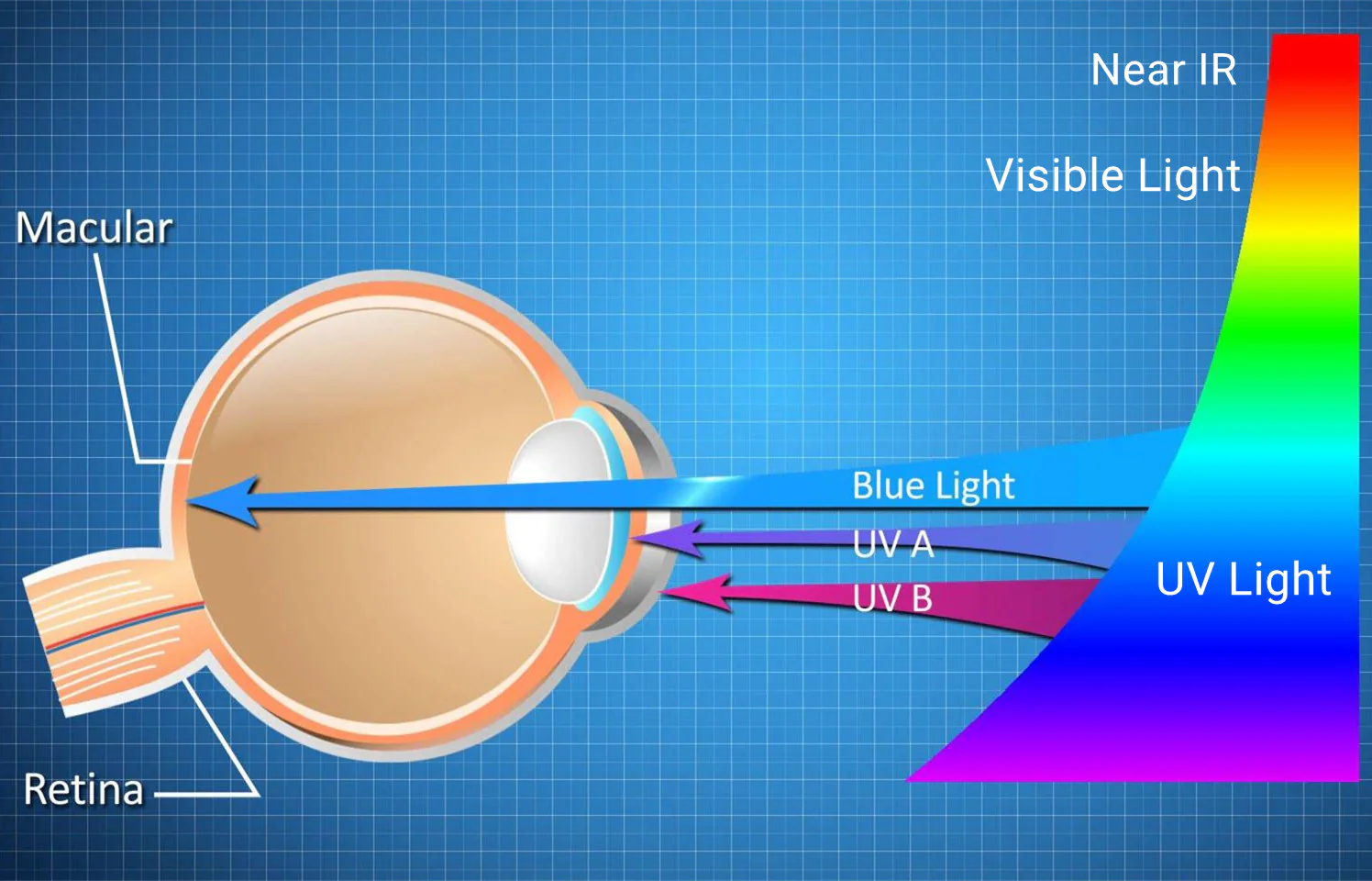 How Can Blue Light Affect Your Eyes